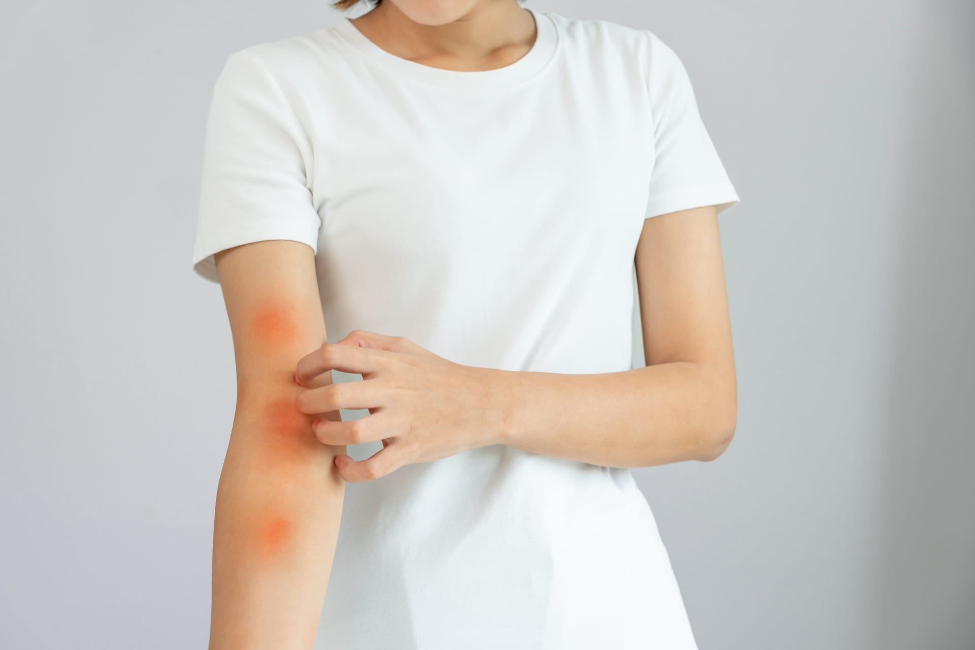 호흡기·피부 질환 악화 가능성